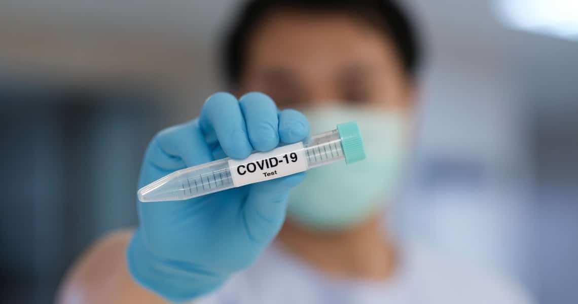 covid-19 diagnostic kits